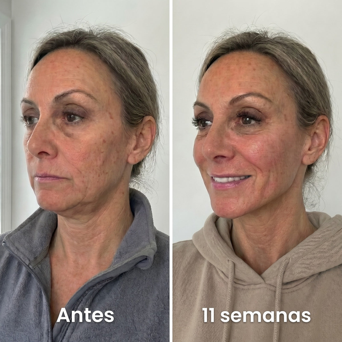 Antes y después: 11 semanas con la Banda Sculpt