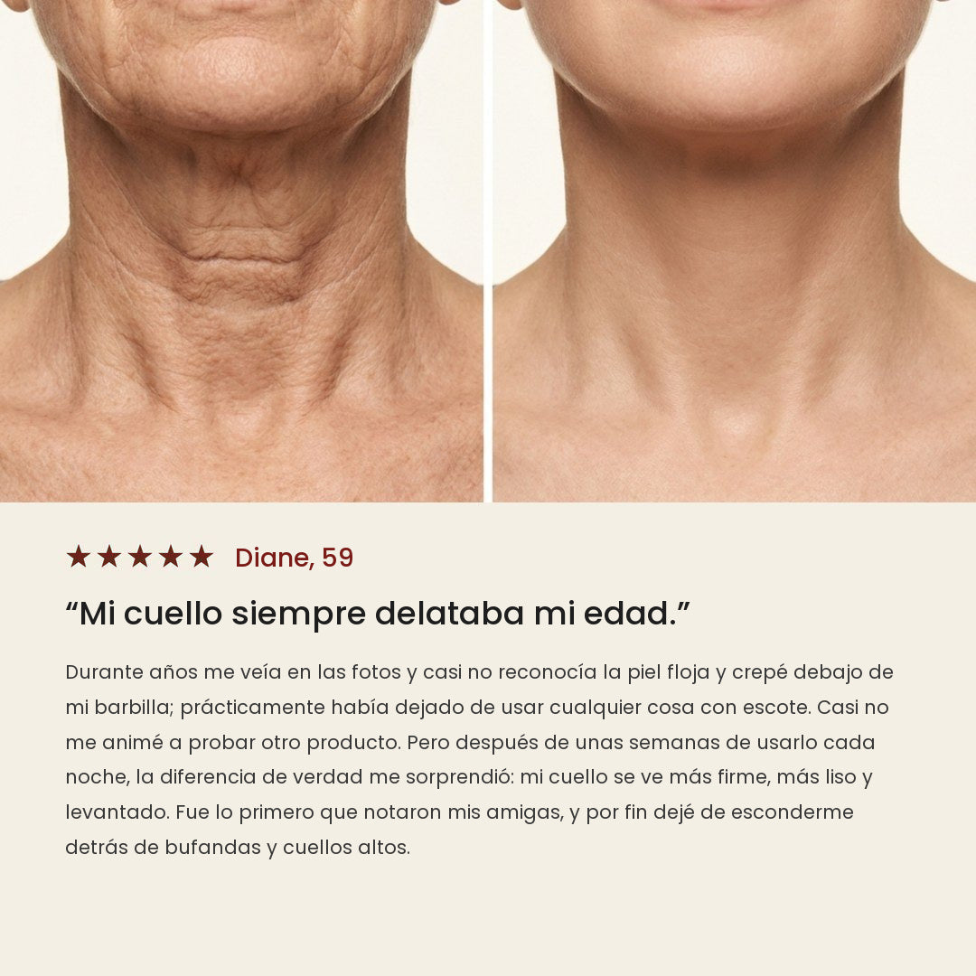 Antes y después en el cuello