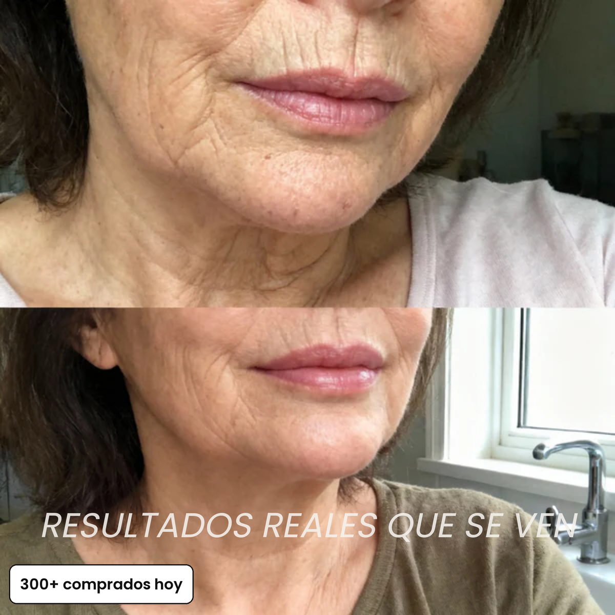 Resultados reales que se ven: antes y después