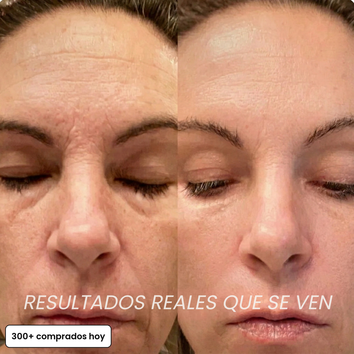 Resultados reales que se ven: antes y después