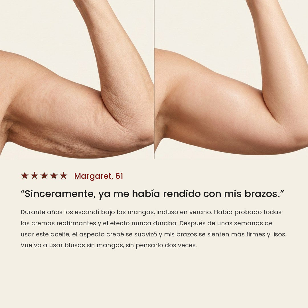 Antes y después en el brazo