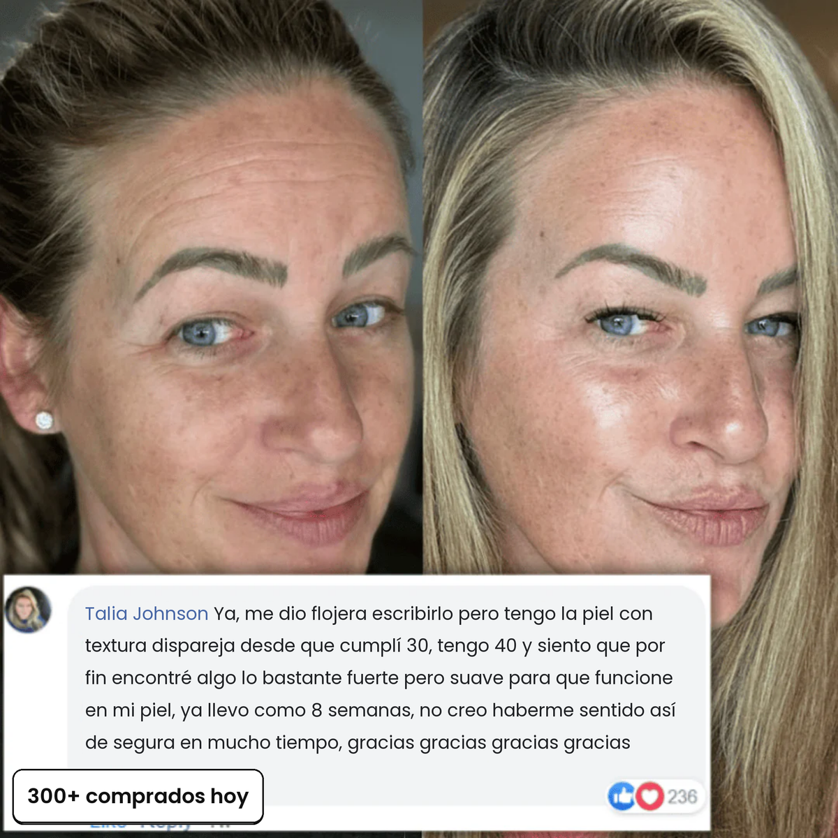Resultados reales que se ven: antes y después con comentario de clienta